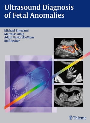 Ultrasound Diagnosis of Fetal Anomalies【電子書籍】