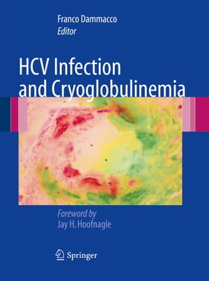 HCV Infection and Cryoglobulinemia【電子書籍】