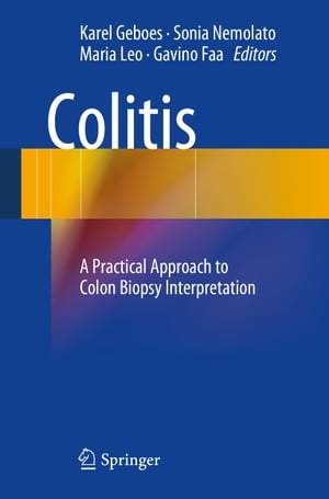 Colitis