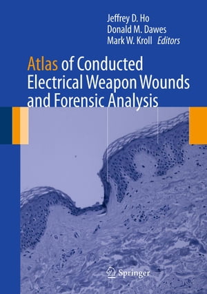 Atlas of Conducted Electrical Weapon Wounds and Forensic Analysis【電子書籍】