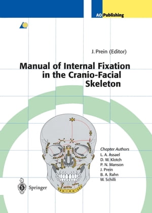 楽天楽天Kobo電子書籍ストアManual of Internal Fixation in the Cranio-Facial Skeleton Techniques Recommended by the AO/ASIF Maxillofacial Group【電子書籍】[ L.A. Assael ]