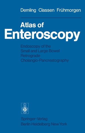 Atlas of Enteroscopy Endoscopy of the Small and Large Bowel; Retrograde Cholangio-Pancreatography【電子書籍】[ H. Koch ]