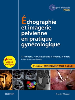 Échographie et imagerie pelvienne en pratique gynécologique