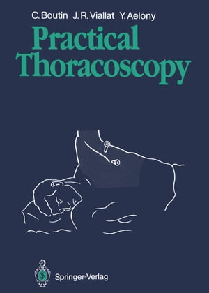 Practical Thoracoscopy