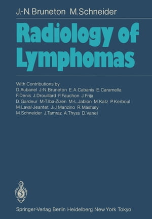 Radiology of Lymphomas