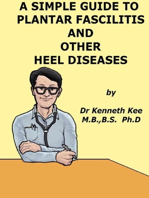 A Simple Guide to Plantar Fascilitis and Heel diseases