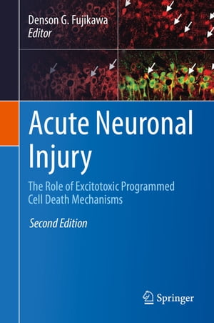 Acute Neuronal Injury The Role of Excitotoxic Programmed Cell Death Mechanisms