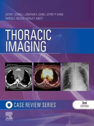 Thoracic Imaging: Case Review Series