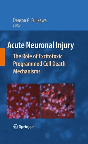 Acute Neuronal Injury The Role of Excitotoxic Programmed Cell Death Mechanisms