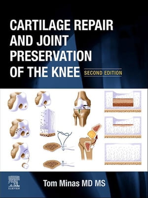 Cartilage Repair and Joint Preservation of the Knee