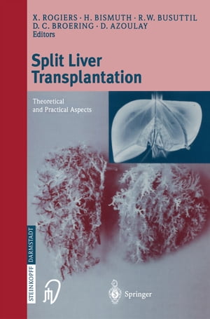 Split liver transplantation Theoretical and practical aspects【電子書籍】
