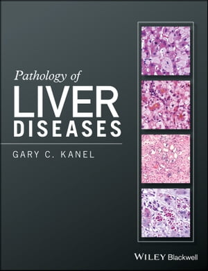 Pathology of Liver Diseases【電子書籍】 Gary C. Kanel