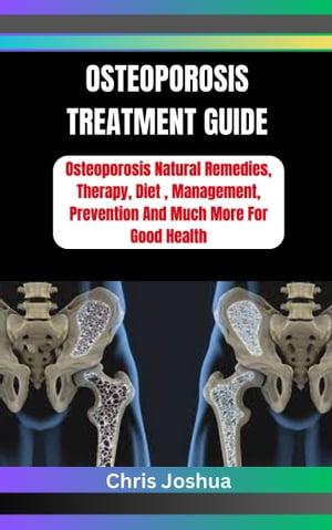 ŷKoboŻҽҥȥ㤨OSTEOPOROSIS TREATMENT GUIDE Osteoporosis Natural Remedies, Therapy, Diet , Management, Prevention And Much More For Good HealthŻҽҡ[ Chris Joshua ]פβǤʤ487ߤˤʤޤ