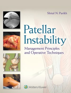 Patellar Instability Management Principles and Operative Techniques