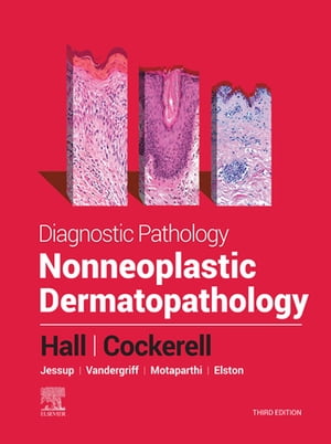 Diagnostic Pathology: Nonneoplastic Dermatopathology - E-Book Diagnostic Pathology: Nonneoplastic Dermatopathology - E-Book【電子書籍】 Brian J. Hall, MD