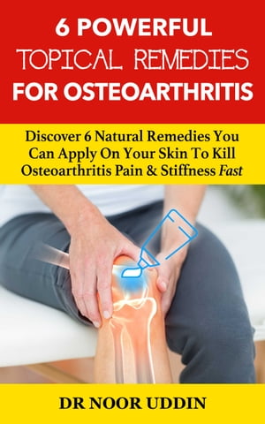 6 Powerful Topical Remedies For Osteoarthritis Discover 6 Natural Remedies You Can Apply On Your Skin To Kill Osteoarthritis Pain Stiffness Fast【電子書籍】 Dr Noor Uddin