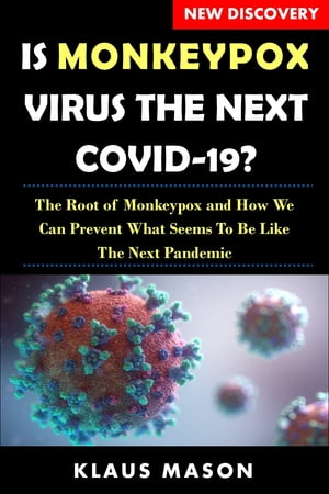 Is monkeypox virus the next covid-19?