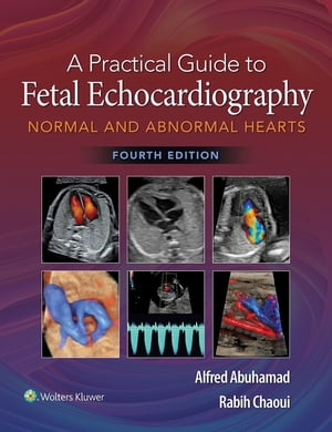 A Practical Guide to Fetal Echocardiography