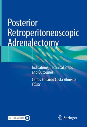 Posterior Retroperitoneoscopic Adrenalectomy