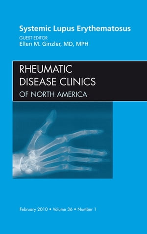 Systemic Lupus Erythematosus, An Issue of Rheumatic Disease Clinics