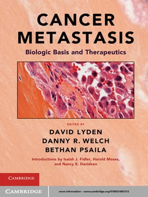 Cancer Metastasis