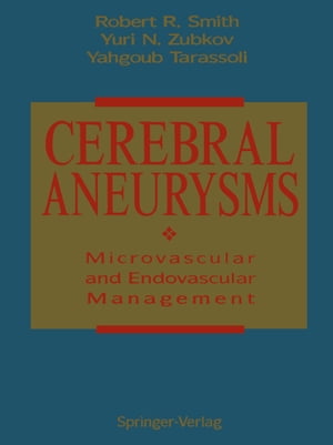 Cerebral Aneurysms