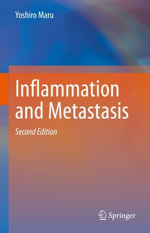 Inflammation and Metastasis