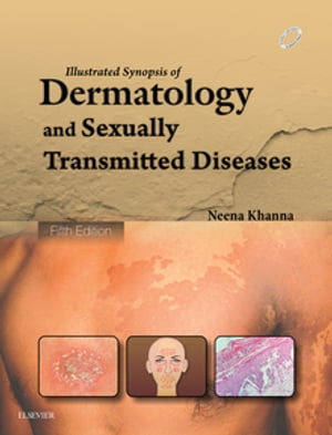 Illustrated Synopsis of Dermatology & Sexually Transmitted Diseases - E-book