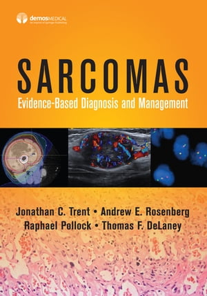 Sarcomas