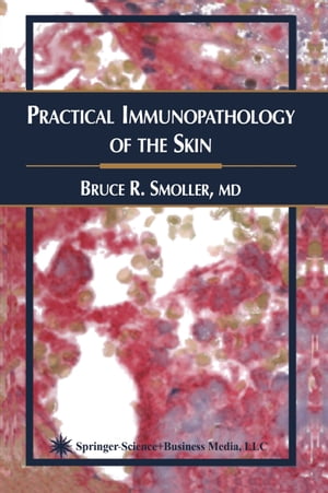 Practical Immunopathology of the Skin【電子書籍】 Bruce R. Smoller