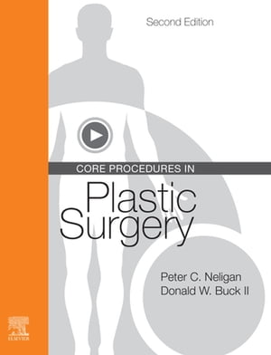 Core Procedures in Plastic Surgery E-BookŻҽҡ[ Peter C. Neligan ]