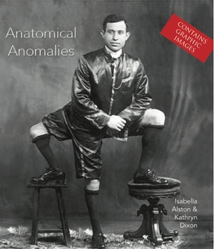 Anatomical Anomalies