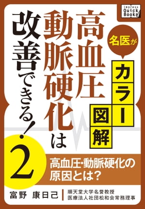 名医がカラー図解! 高血圧・動脈硬化は改善できる! (2) 高血圧・動脈硬化の原因とは？