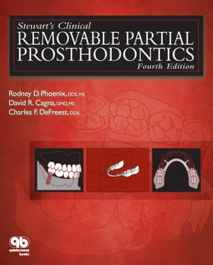 Stewart's Clinical Removable Partial Prosthodontics Fourth Edition【電子書籍】[ Rodney D. Phoenix ]