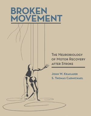 Broken Movement The Neurobiology of Motor Recovery after Stroke