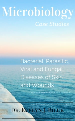 ŷKoboŻҽҥȥ㤨Microbiology Case Studies: Bacterial and Parasitic Diseases of Skin and WoundsŻҽҡ[ Dr. Evelyn J Biluk ]פβǤʤ519ߤˤʤޤ