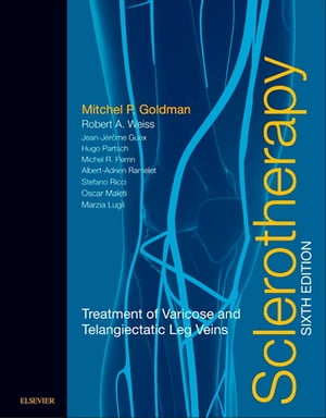 Sclerotherapy E-Book