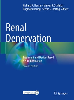 Renal Denervation Treatment and Device-Based Neuromodulation【電子書籍】