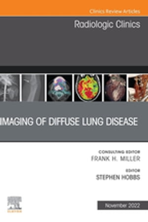 Imaging of Diffuse Lung Disease, An Issue of Radiologic Clinics of North America, E-Book