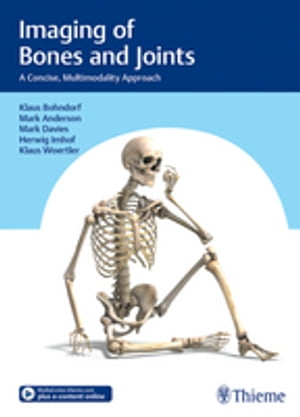 Imaging of Bones and Joints