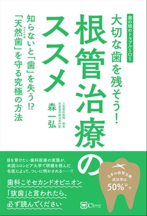 大切な歯を残そう！根管治療のススメ