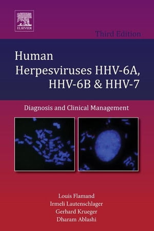 Human Herpesviruses HHV-6A, HHV-6B and HHV-7