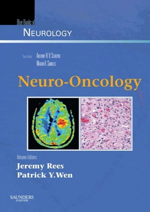 Neuro-Oncology