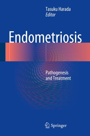 Endometriosis