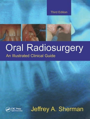 Oral Radiosurgery