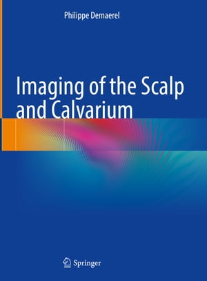 Imaging of the Scalp and Calvarium【電子書籍】[ Philippe Demaerel ]