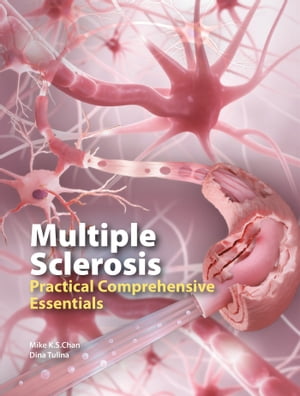 Multiple Sclerosis