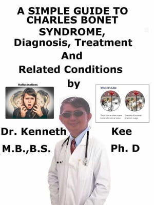 A Simple Guide to Charles Bonnet Syndrome, Diagnosis, Treatment and Related Conditions