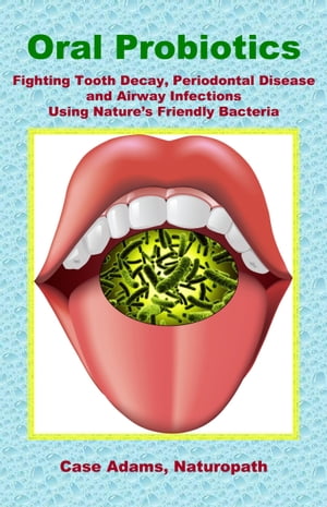 Oral Probiotics: Fighting Tooth Decay, Periodontal Disease and Airway Infections Using Natures Friendly BacteriaŻҽҡ[ Case Adams, Naturopath ]