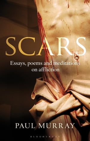 Scars